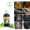 ADIVASI HERBAL NILAMBARI HAIR OIL! PACK OF 2 (BUY 1 GET 1 FREE)(4.9 ⭐⭐⭐⭐⭐ 93,830 REVIEWS) NEW